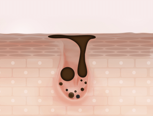 肌の汚れをとる動画